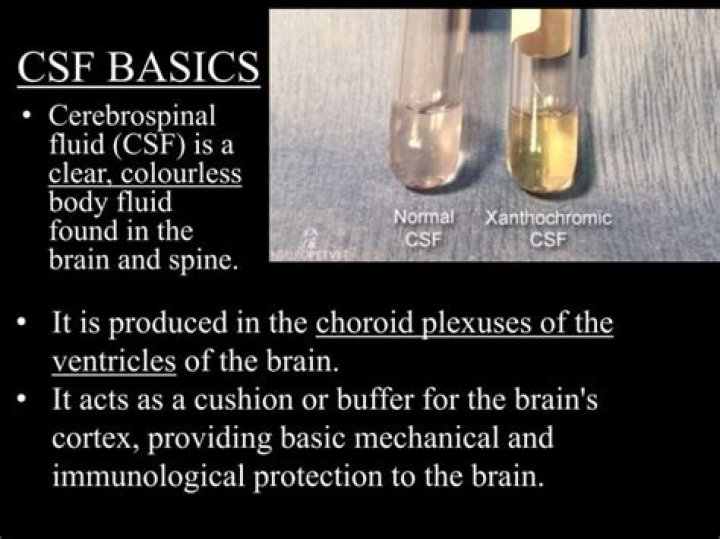Can cerebrospinal fluid be yellow