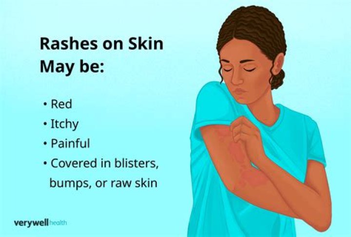 Can you get a rash from pine trees