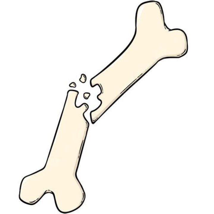 Can you get sick from a broken bone