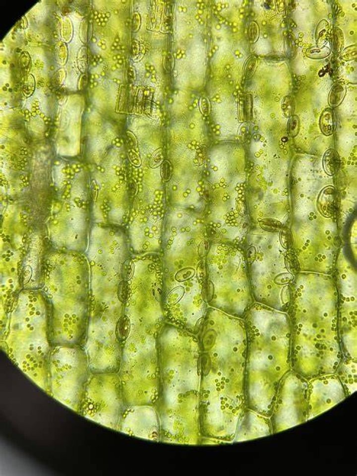 Can you see STD under microscope