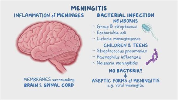 How is bacterial meningitis transmitted