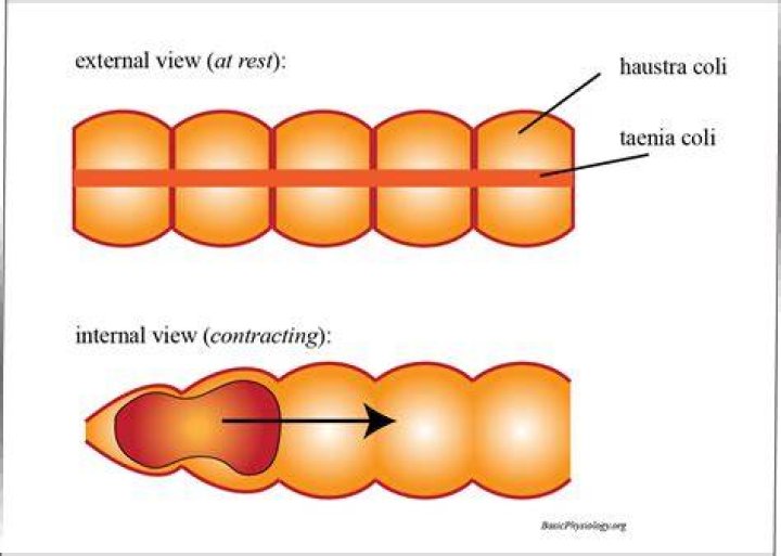 What causes Haustra