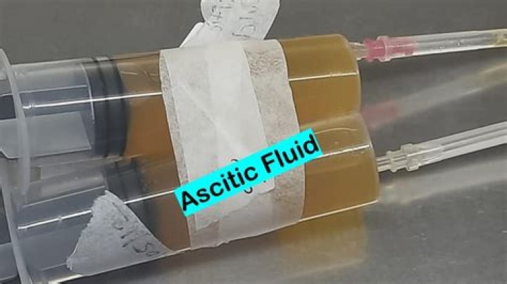 What do you give ascitic fluid for