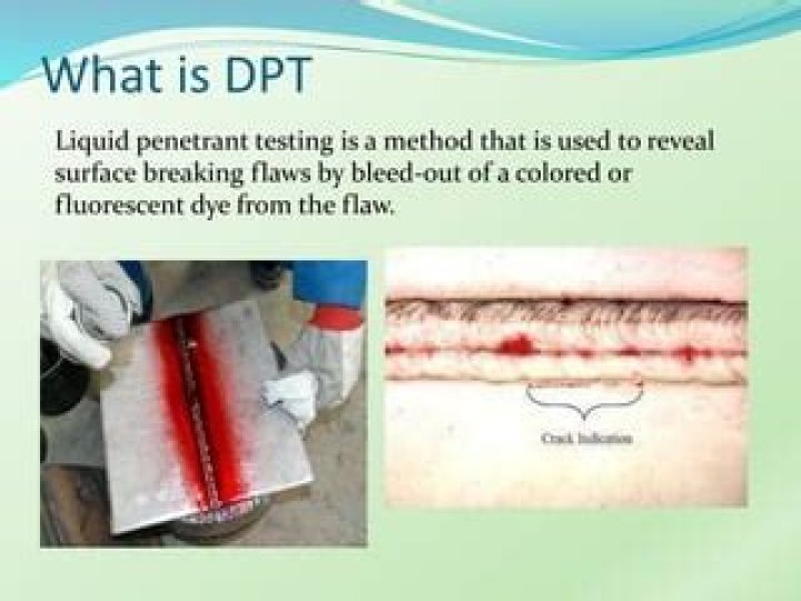 What is DPT test