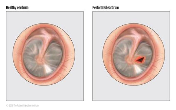 What is your eardrum